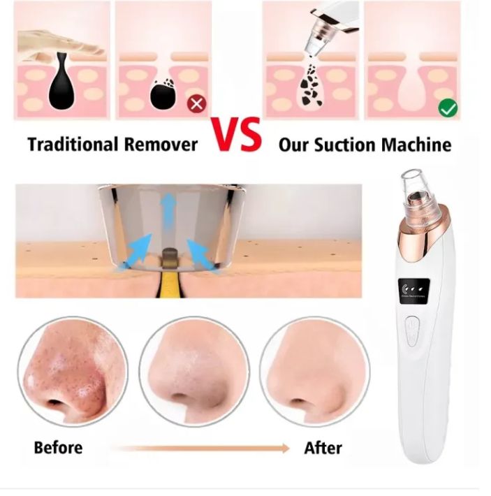 Herbal Glow Derma Suction – Instant Blackhead Remover Herbal Glow