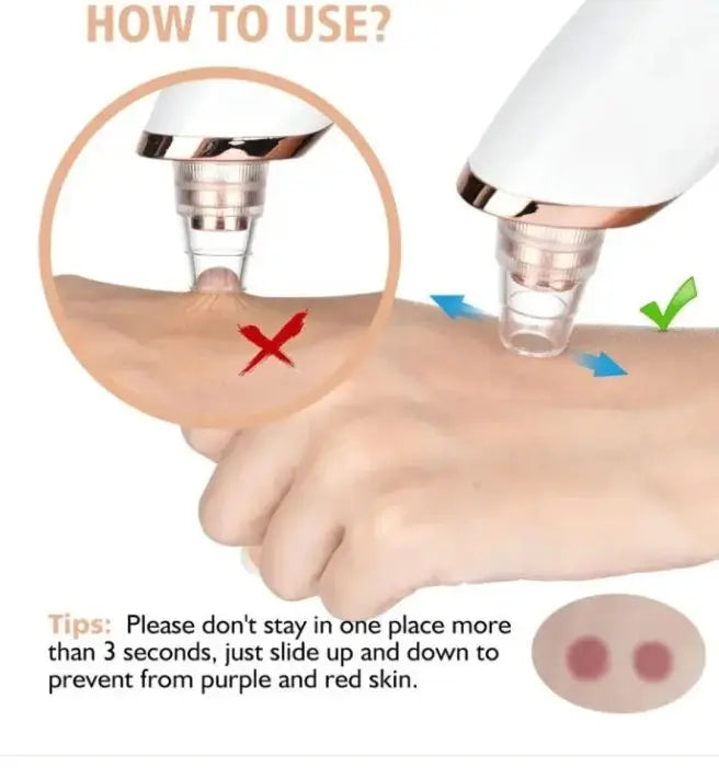 Herbal Glow Derma Suction – Instant Blackhead Remover Herbal Glow