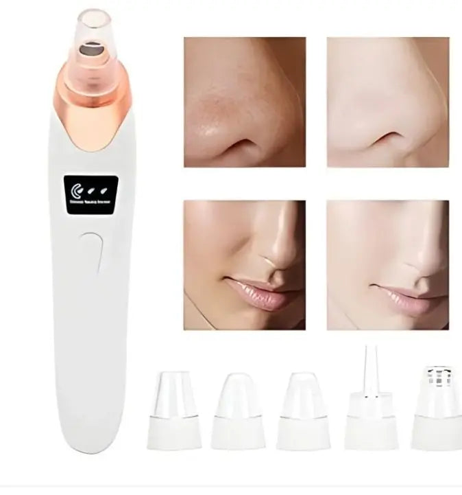 Herbal Glow Derma Suction – Instant Blackhead Remover Herbal Glow